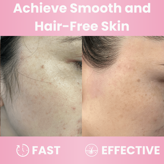 Veloria Oil™ | Cyperus Rotundus Smooth Skin Formula